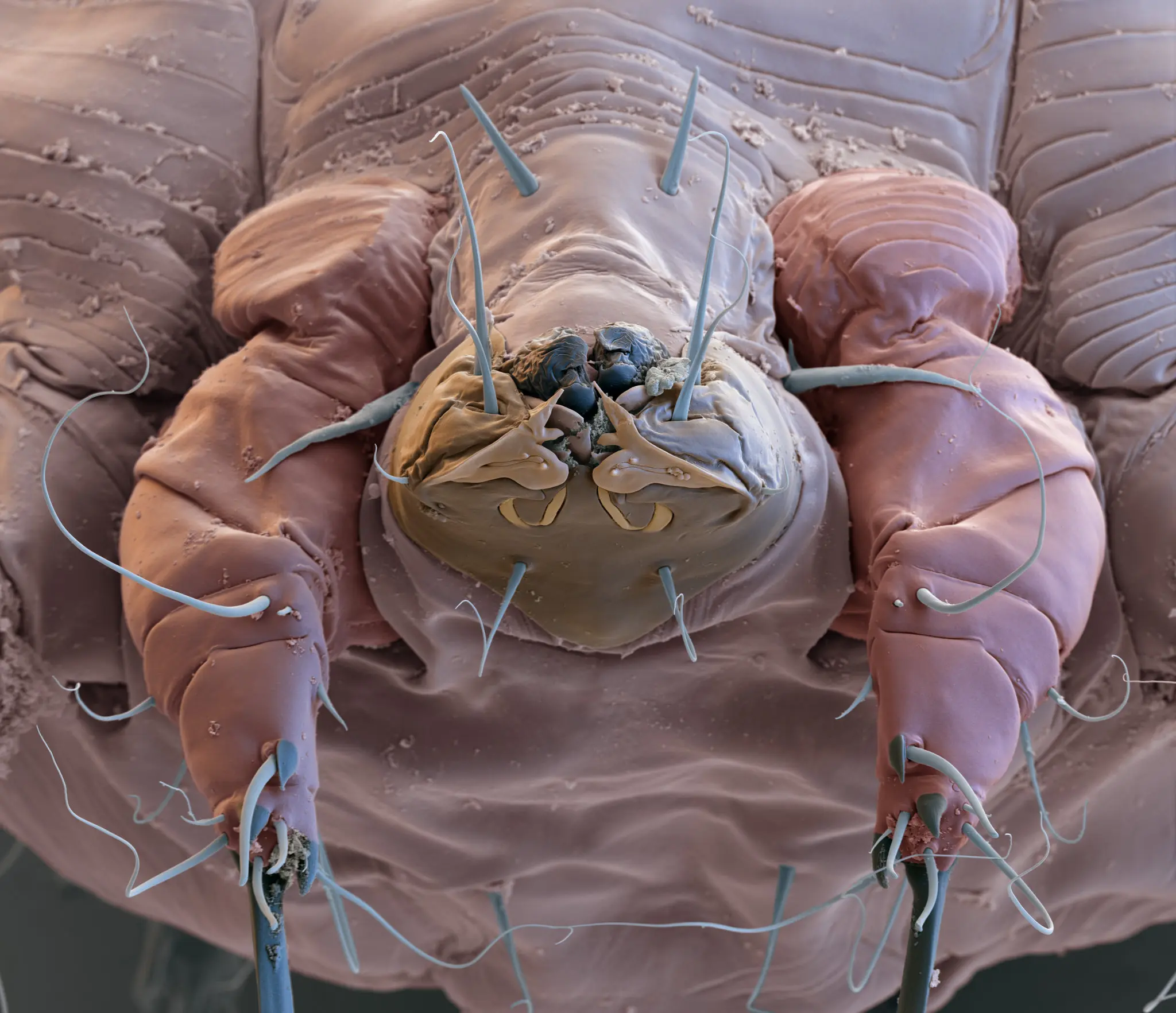 Breakthrough Oral Drug Offers Hope in Global Fight Against Scabies